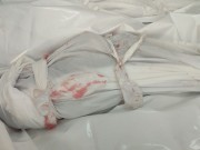 3 شهداء بينهم طفلا وامرأة جراء قصف الاحتلال خيمة غربي بيت لاهيا