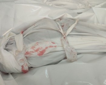 حنجرة صدحت في وجه الإبادة.. أسرة الطفل حسن عياد تروي قصة استشهاده