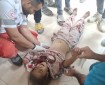 مصابون جراء قصف الاحتلال خيمة نازحين في منطقة المواصي غربي مدينة خان يونس