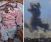 ولادة طفلة "بلا دماغ" مع تزايد ظاهرة "تشوه الأجنة" في قطاع غزة