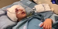 الخارجية تدعو المنظمات الحقوقية والإنسانية إلى توثيق جريمة الاحتلال بحق الطفل مالك عيسى