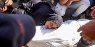 شهيد ومصابون في قصف للاحتلال على مدينة غزة