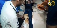الهمص: لا نجد أدوية لعلاج الأطفال والاحتلال يستخدم أسلحة محرمة تحرق الأجساد