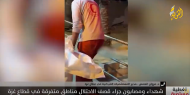 براءة غزة تحت الحصار.. مستشفيات تئن بين الدمار والموت